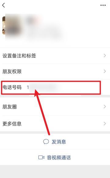电话如何备注苹果手机名称？操作步骤是怎样的？